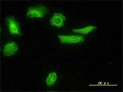 Immunocytochemistry/ Immunofluorescence: ARH Antibody (4G4-D5) [H00026119-M01]