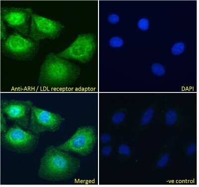 Immunocytochemistry/ Immunofluorescence: ARH Antibody [NB100-1276]