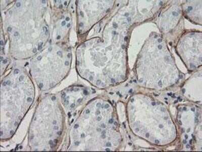Immunohistochemistry: ARH Antibody (OTI7E11) - Azide and BSA Free [NBP2-71790]