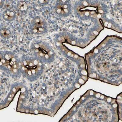 Immunohistochemistry-Paraffin: ARHGAP1 Antibody [NBP1-85725]