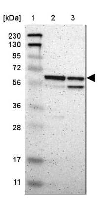 Western Blot: ARHGAP1 Antibody [NBP1-85725]