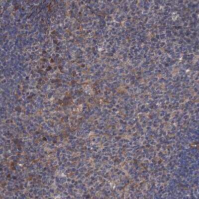Immunohistochemistry-Paraffin: ARHGAP11A Antibody [NBP1-93657]