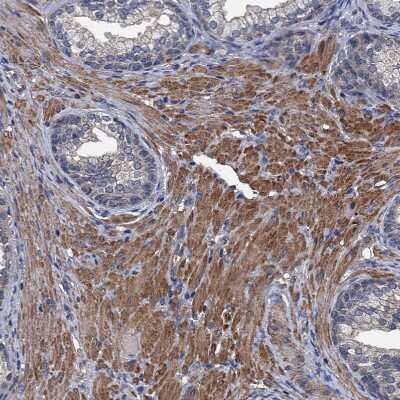 Immunohistochemistry-Paraffin: ARHGAP11A Antibody [NBP1-93657]