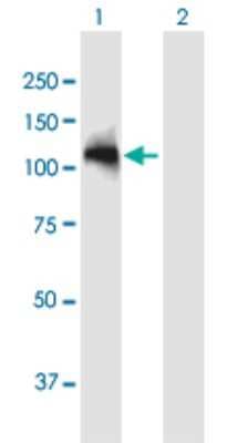 Western Blot: ARHGAP12 Antibody [H00094134-B01P]