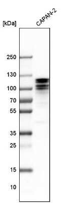 Western Blot: ARHGAP12 Antibody [NBP1-91678]