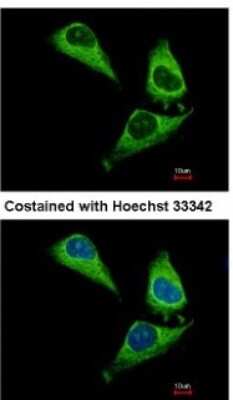Immunocytochemistry/ Immunofluorescence: ARHGAP15 Antibody [NBP2-15452]