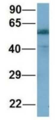 Western Blot: ARHGAP15 Antibody [NBP1-56885]