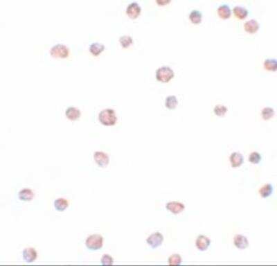 Immunocytochemistry/ Immunofluorescence: ARHGAP18 Antibody - BSA Free [NBP2-81704]