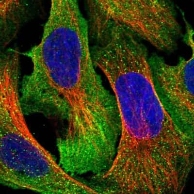 Immunocytochemistry/ Immunofluorescence: ARHGAP19 Antibody [NBP1-94047]