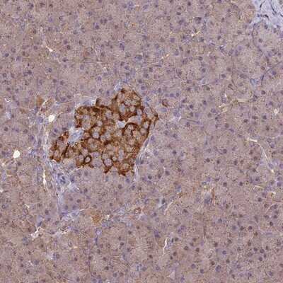 Immunohistochemistry-Paraffin: ARHGAP19 Antibody [NBP1-94047]