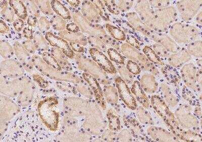 Immunohistochemistry-Paraffin: ARHGAP19 Antibody [NBP3-12578]