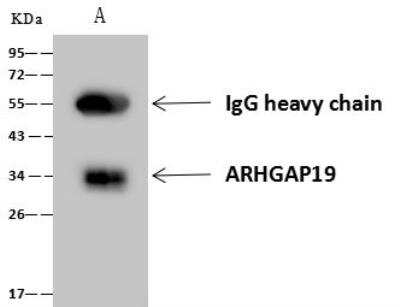 Immunoprecipitation: ARHGAP19 Antibody [NBP3-12578]