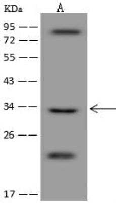 Western Blot: ARHGAP19 Antibody [NBP3-12578]