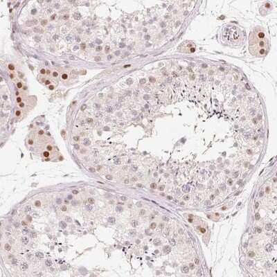 Immunohistochemistry: ARHGAP22 Antibody [NBP2-39028]