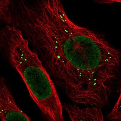 Immunocytochemistry/ Immunofluorescence: ARHGAP25 Antibody [NBP2-57228]