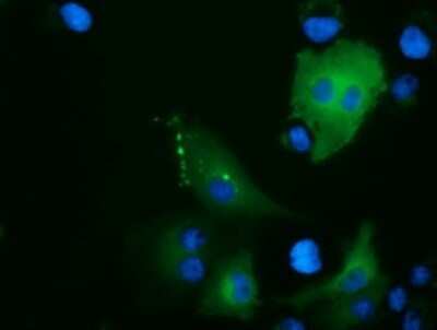 Immunocytochemistry/ Immunofluorescence: ARHGAP25 Antibody (OTI2D5) - Azide and BSA Free [NBP2-71508]