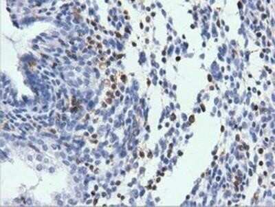 Immunohistochemistry: ARHGAP25 Antibody (OTI2D5) - Azide and BSA Free [NBP2-71508]