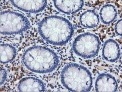 Immunohistochemistry: ARHGAP25 Antibody (OTI2D5) - Azide and BSA Free [NBP2-71508]