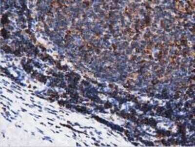 Immunohistochemistry-Paraffin: ARHGAP25 Antibody (OTI2D5) [NBP2-03024]