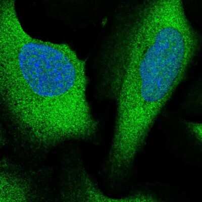 Immunocytochemistry/ Immunofluorescence: ARHGAP27 Antibody [NBP2-55668]