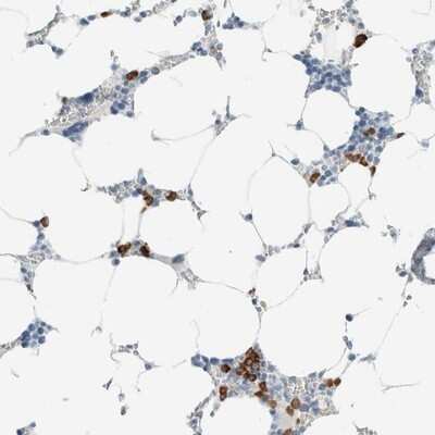 Immunohistochemistry-Paraffin: ARHGAP27 Antibody [NBP1-91223]