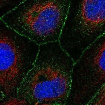 Immunocytochemistry/ Immunofluorescence: ARHGAP28 Antibody [NBP1-84642]
