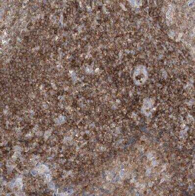 Immunohistochemistry-Paraffin: ARHGAP30 Antibody [NBP1-84653]
