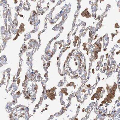 Immunohistochemistry-Paraffin: ARHGAP30 Antibody [NBP1-84653]