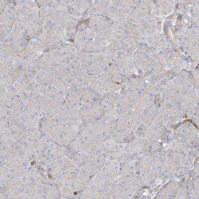 Immunohistochemistry-Paraffin: ARHGAP30 Antibody [NBP1-84653]