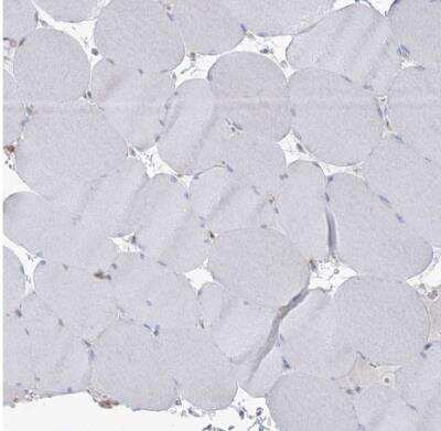 Immunohistochemistry-Paraffin: ARHGAP30 Antibody [NBP1-84653]