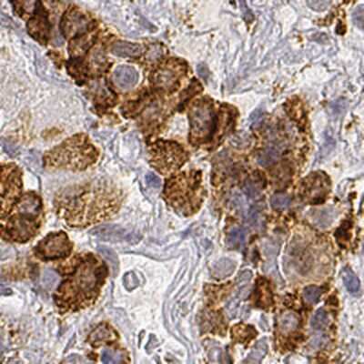 Immunohistochemistry-Paraffin: ARHGAP36 Antibody [NBP1-93894]