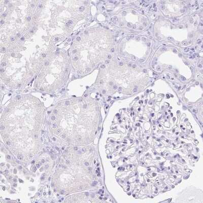 Immunohistochemistry-Paraffin: ARHGAP36 Antibody [NBP1-93894]