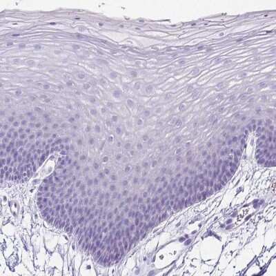 Immunohistochemistry-Paraffin: ARHGAP36 Antibody [NBP1-93894]