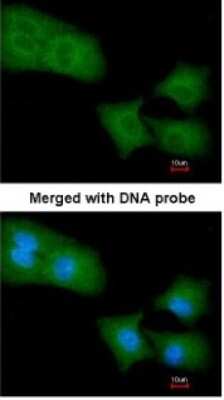 Immunocytochemistry/ Immunofluorescence: ARHGAP4 Antibody [NBP1-31976]
