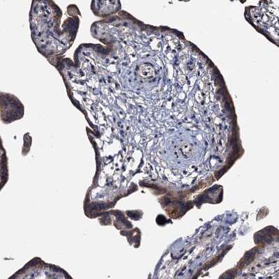 Immunohistochemistry-Paraffin: ARHGAP42 Antibody [NBP1-93869]