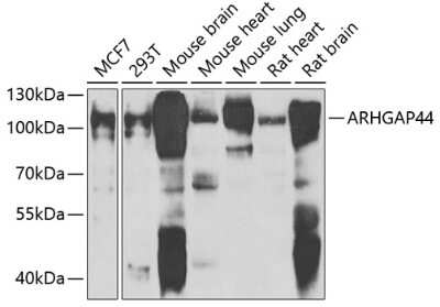 Western Blot: ARHGAP44 AntibodyBSA Free [NBP2-92492]