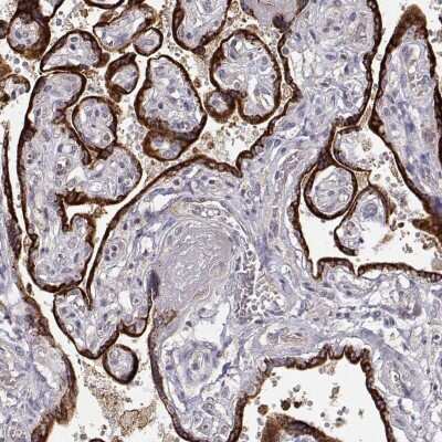 Immunohistochemistry-Paraffin: ARHGAP8 Antibody [NBP2-57680]