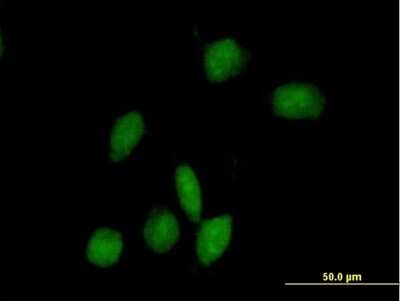 Immunocytochemistry/ Immunofluorescence: ARHGAP9 Antibody [H00064333-B01P]