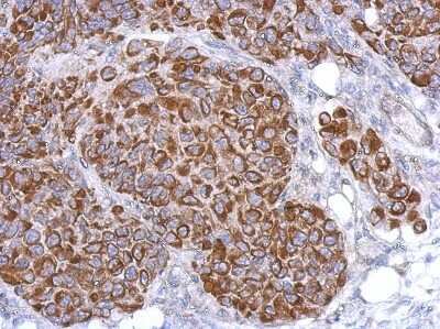 Immunohistochemistry-Paraffin: ARHGAP9 Antibody [NBP2-15454]