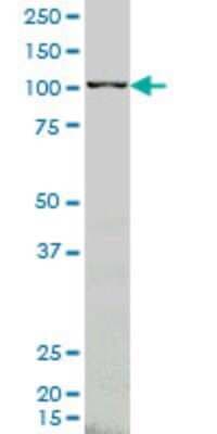 Western Blot: ARHGEF1 Antibody (4C4) [H00009138-M03]