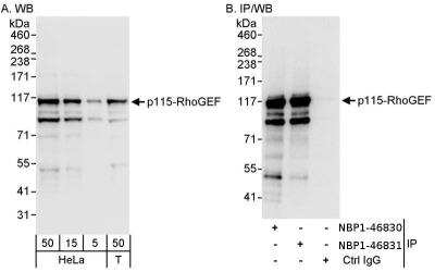 Immunoprecipitation: ARHGEF1 Antibody [NBP1-46831]