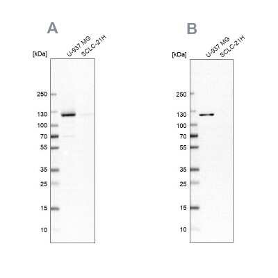 Western Blot: ARHGEF1 Antibody [NBP1-82843]