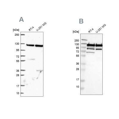 Western Blot: ARHGEF1 Antibody [NBP2-56320]