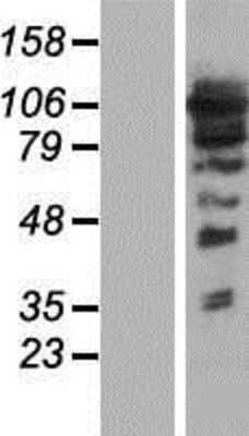 Western Blot: ARHGEF1 Overexpression Lysate [NBP2-04661]
