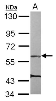 Western Blot: ARHGEF3 Antibody [NBP2-15456]