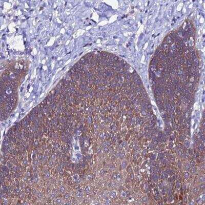 Immunohistochemistry: ARHGEF35 Antibody [NBP2-46718]