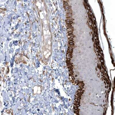 Immunohistochemistry-Paraffin: ARHGEF38 Antibody [NBP1-93985]