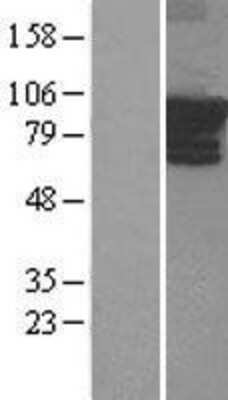 Western Blot: ARHGEF4 Overexpression Lysate [NBL1-07682]