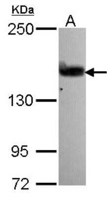 Western Blot: ARHGEF5 Antibody [NBP2-15457]