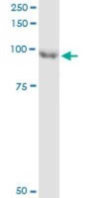 Immunoprecipitation: ARHGEF6 Antibody (2E5) [H00009459-M02]